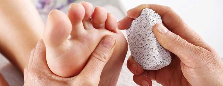 How to Get Rid of Calluses on Feet